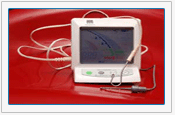 dentist in velachery, Dental implant centre in Chennai, Smile designing centre, Dental tourism in Chennai, Full mouth rehabilitation centre, Dental implantologist in velachery, best orthodontic centre in Chennai, dental clinics in chennai, chennai dentist, dentist in Chennai, dental clincs in india, dental clinc in india, dental hospitals in chennai, dental hospitals in india, Esthetic smile centre